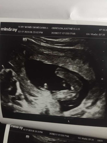 Is it a boy or a girl?