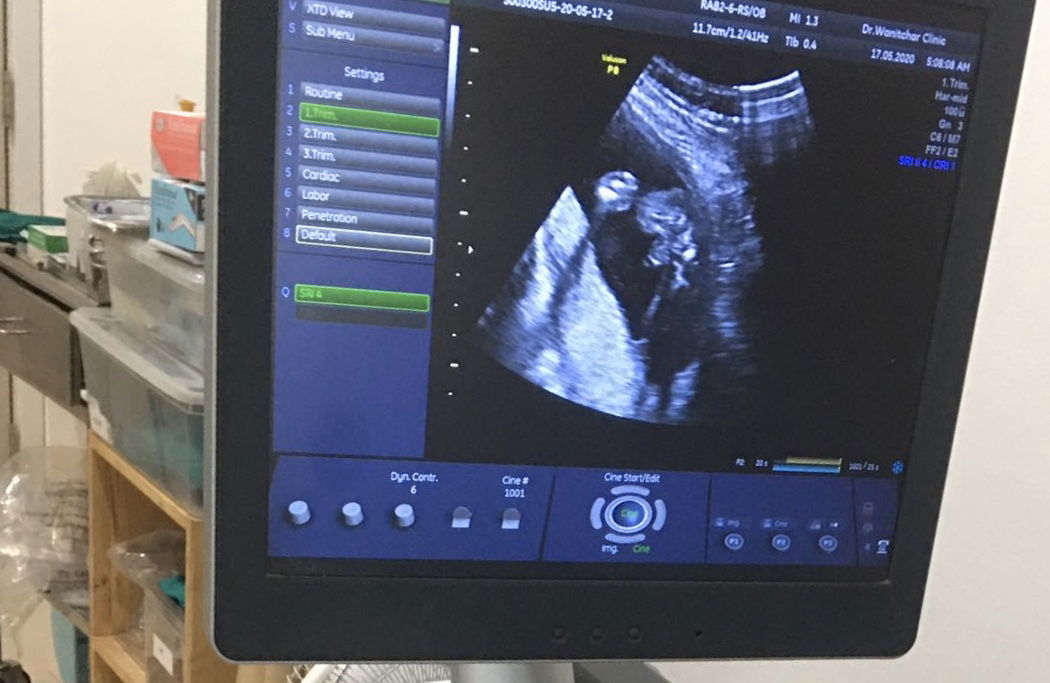 คุณแม่ที่มีประสบการณ์ ช่วยดูหน่อยคะ ญ หรือชายคะ