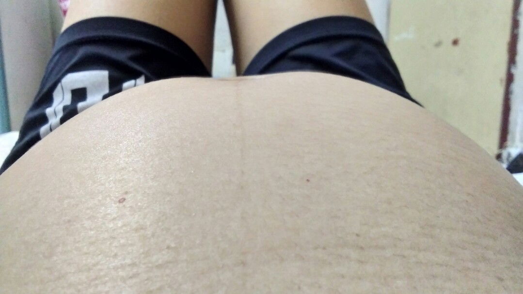 ท้องไม่กลม แม่บ้านไหนท้องเป็นแบบเราบ้าง