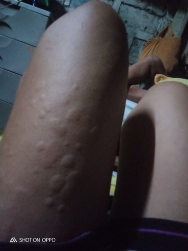 lamig?