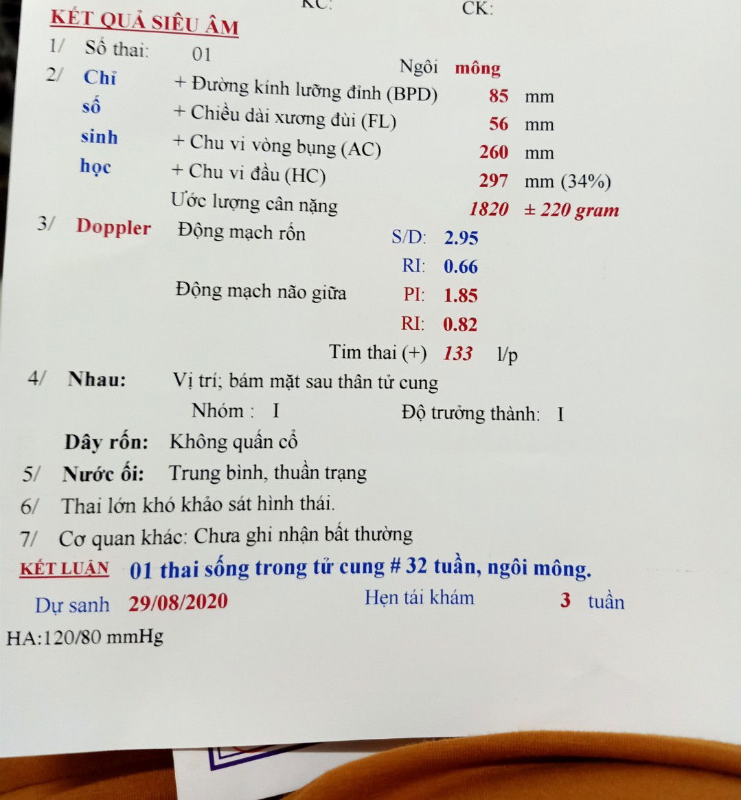 các mom cho e hỏi ngôi mông có dễ sinh không ạ?