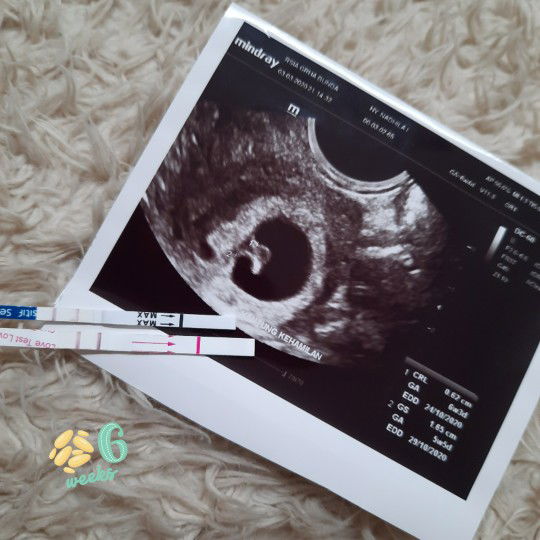 cerita kehamilan pertamaku