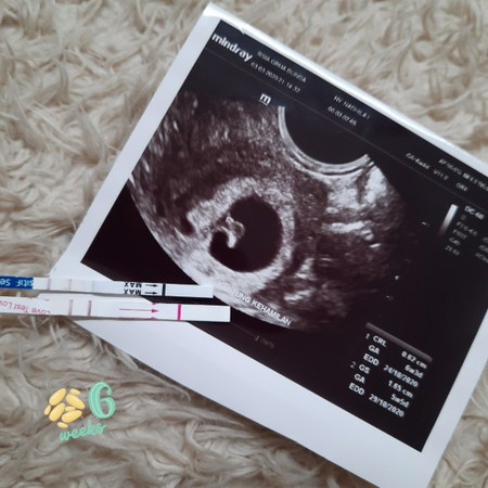 cerita kehamilan pertamaku