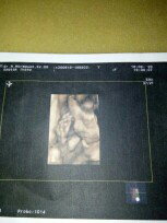 hasil usg 24week