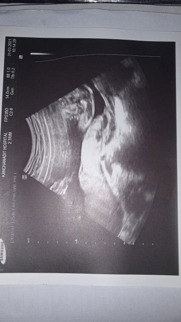 ษัณมาส เสกกาญจนะ profile icon