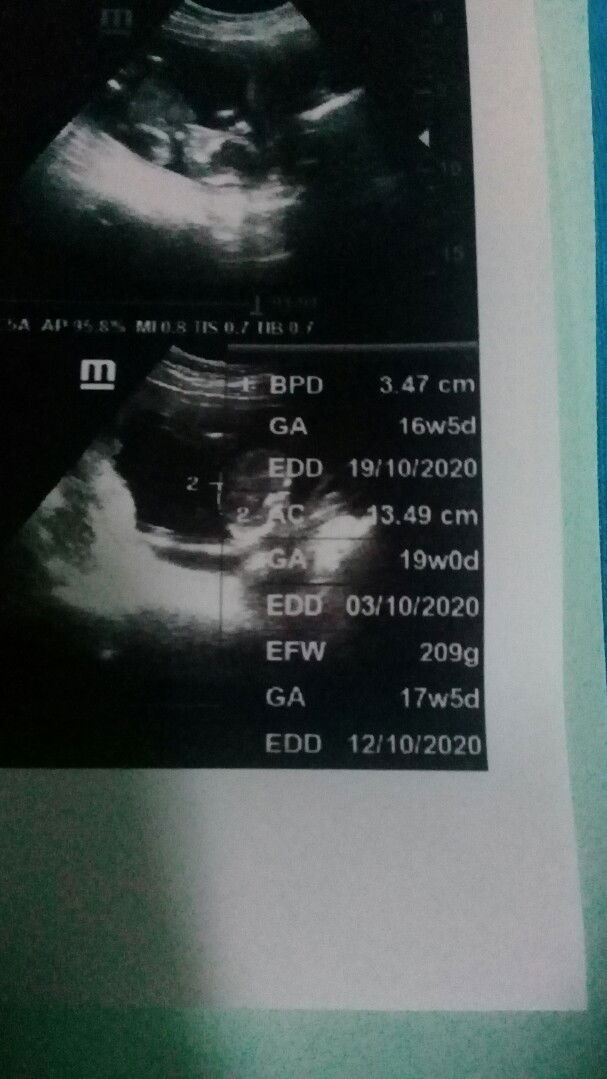 bun tolong di jelasin