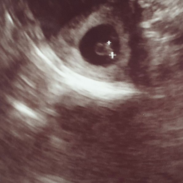 Alice D profile icon