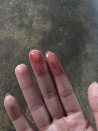เลือดออกตอนมีเซ็กส์