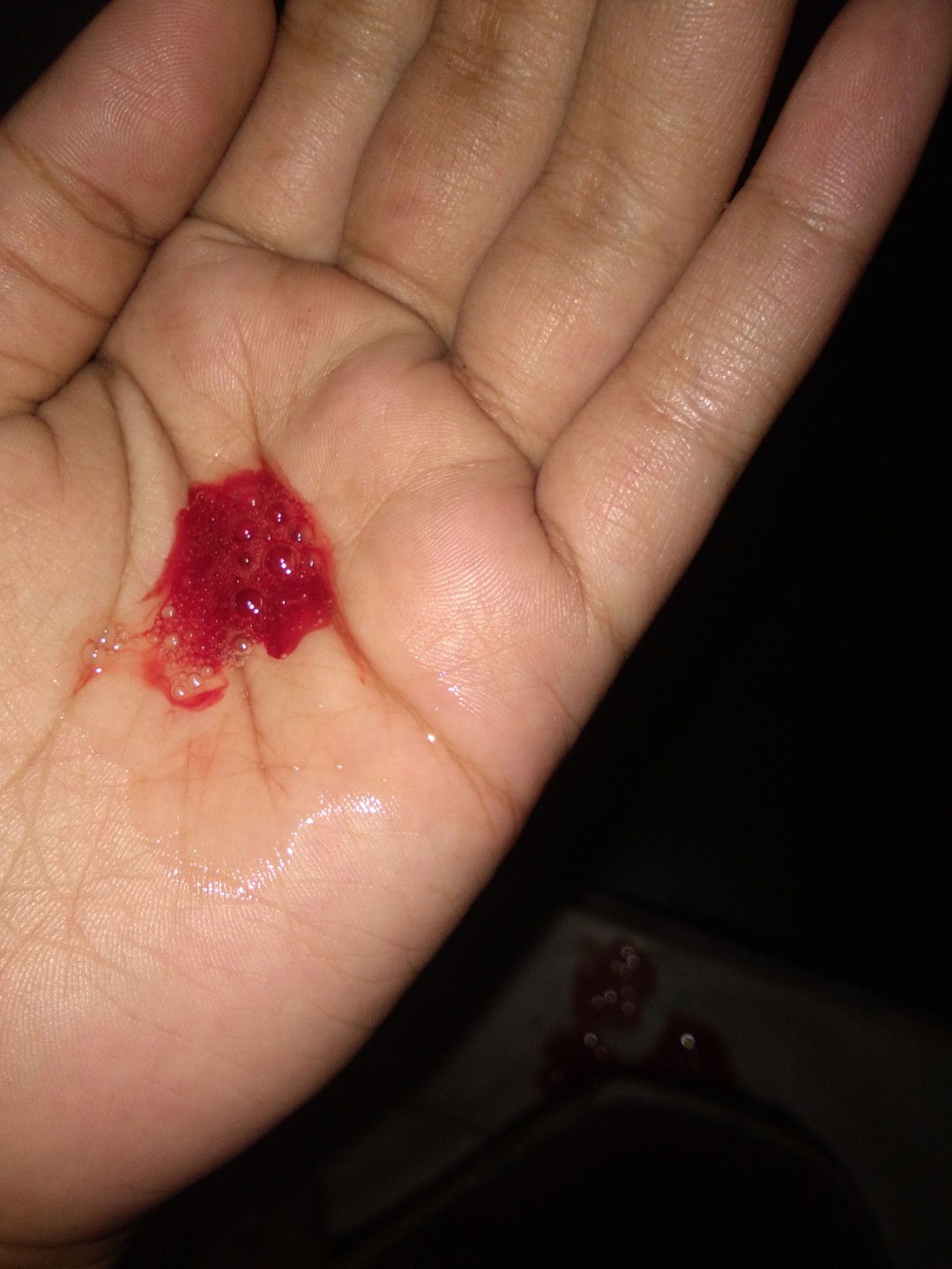 mutah berdarah keluar darah di anus