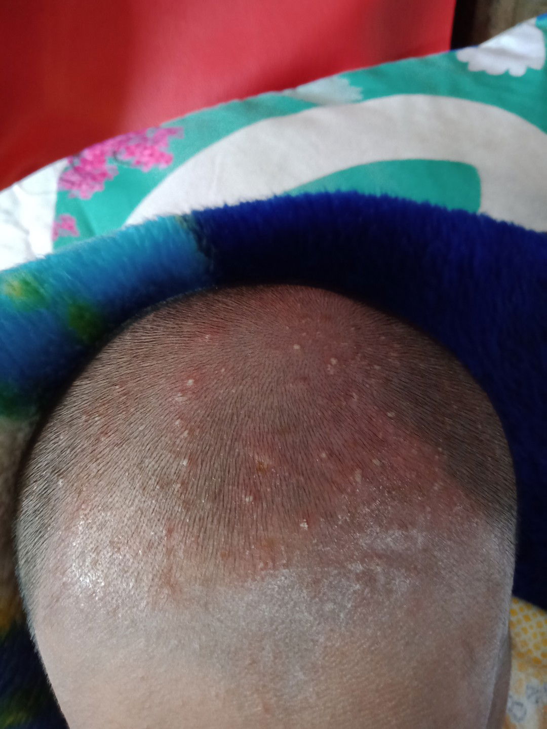 obatnya apa ya bunda..??