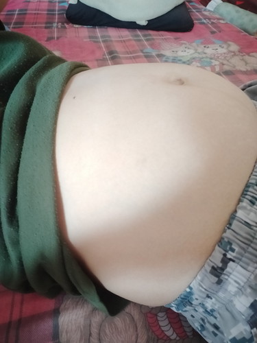 ท้องเล็กไปไมค่ะ