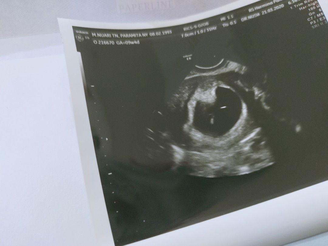 detak jantung tidak ada