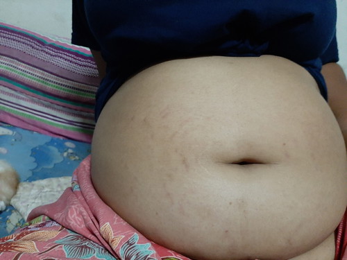ขอดูท้องแม่ๆ ท้อง3เดือนหน่ยจ้า