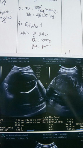 bun dsni ada yg usg bayi ny ke lilit tali pusar g?