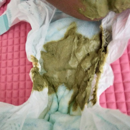 Baby's poop