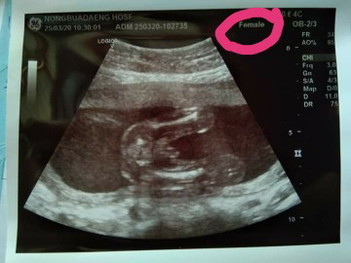 ?