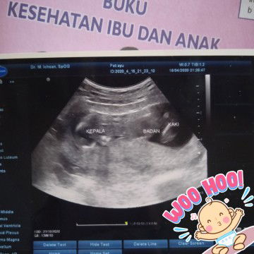 posisi bayi lucu