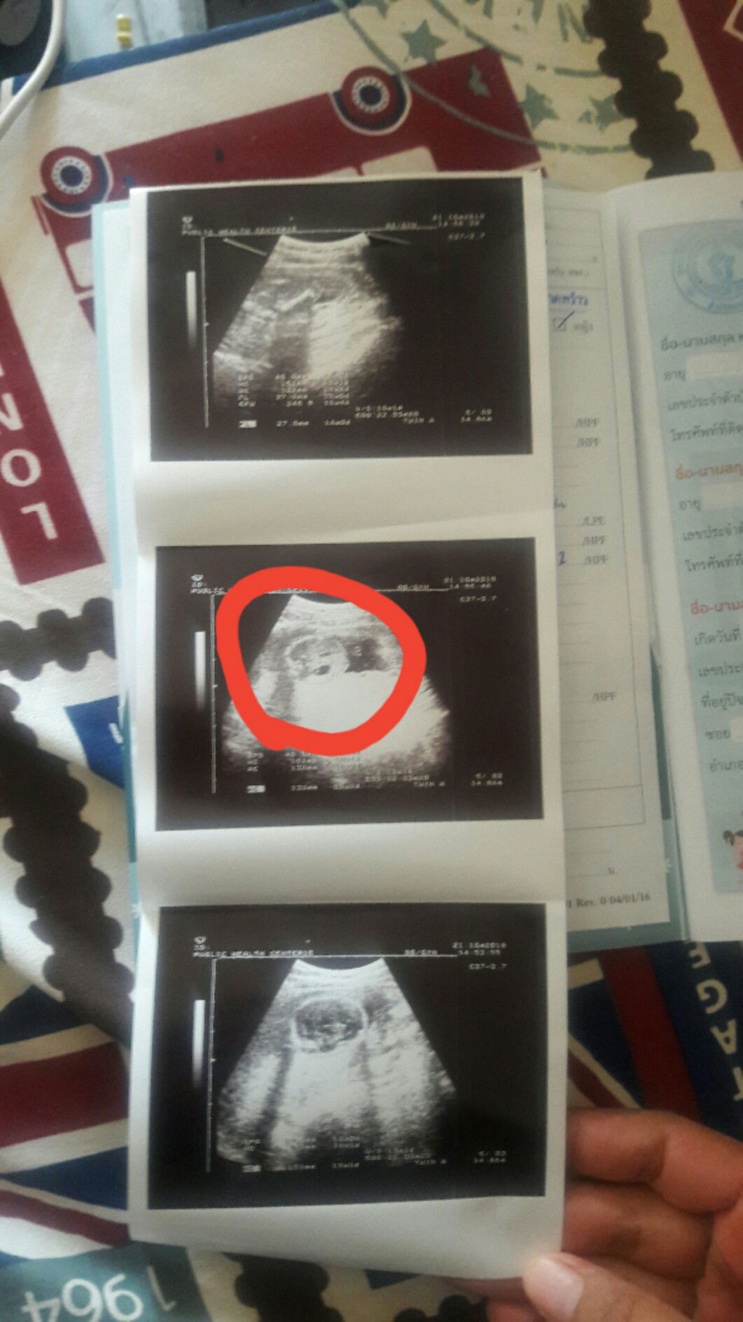 Supalup ray profile icon