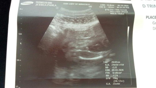 First Baby ?