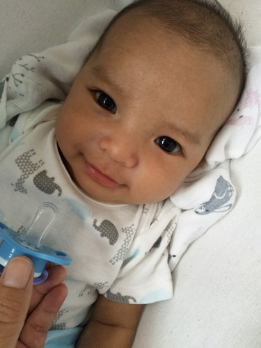 ลูกชาย 2 เดือน หัวเบี้ยว