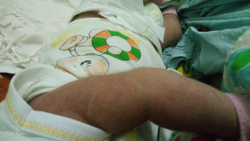 Bun rekom dong cream untuk kulit bayi yang kemerehan karna alergi