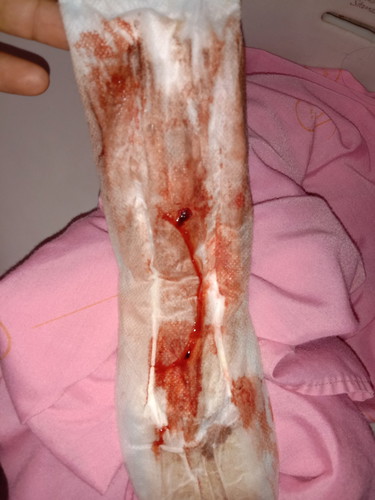 อยากจะสอบถามหน่อยค่ะแม่ๆใครเคยมีประสบการณ์แท้งคุกคามบ้างคะ