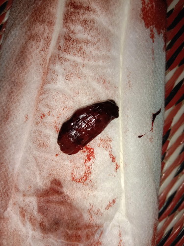 อยากสอบถามหน่อยค่ะใครเคยแท้งแบบไม่ปวดท้องไหมคะ