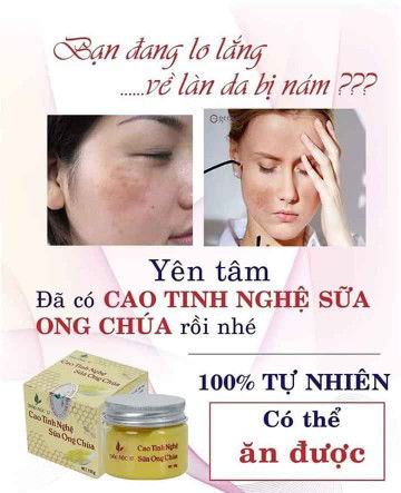 Bí Quyết Chăm sóc Da Mặt Trước Và Sau Sinh