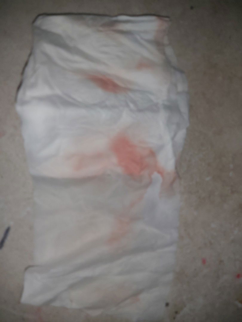 bleeding at 13 weeks