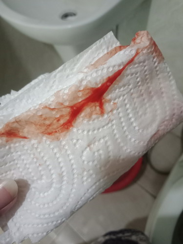 มูกเลือด