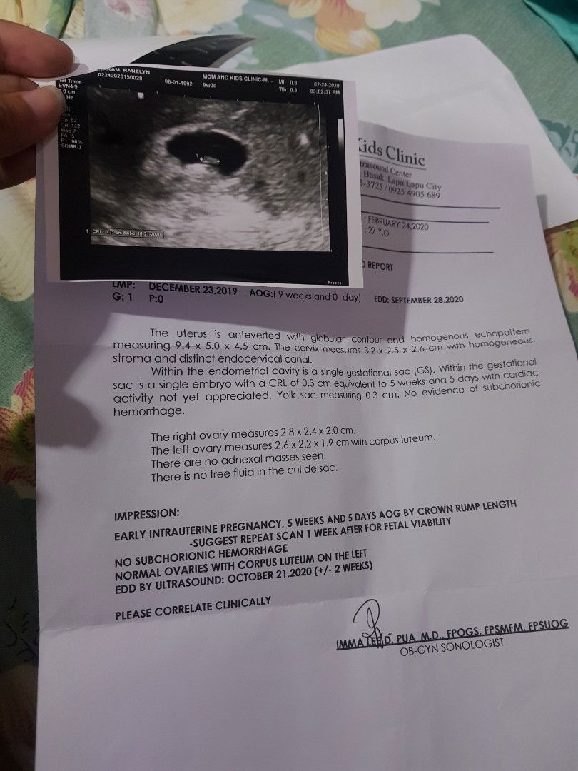 PATULONG MGA SIS (FIRST TIME &WORRIED)