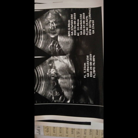 ดูยังไง