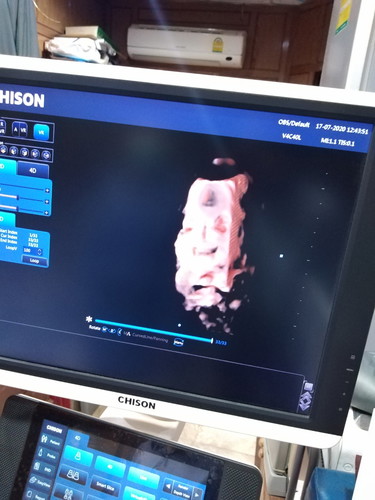 สมใจคุณพ่อแล้ว