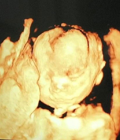 พรทิพย์ ม่วงผุย profile icon