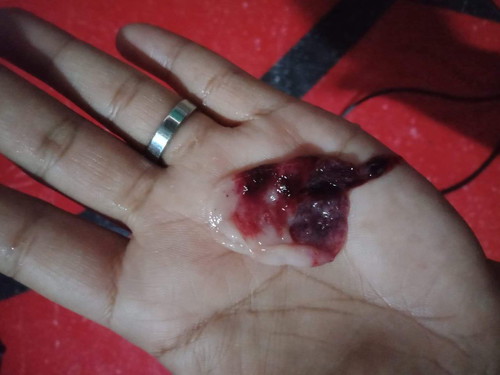 ถามให้เพื่อนค่ะ