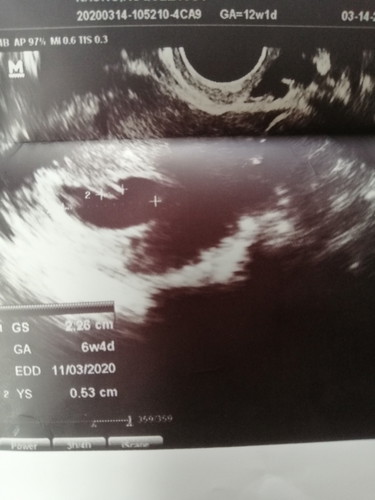 6 weeks and 4 days