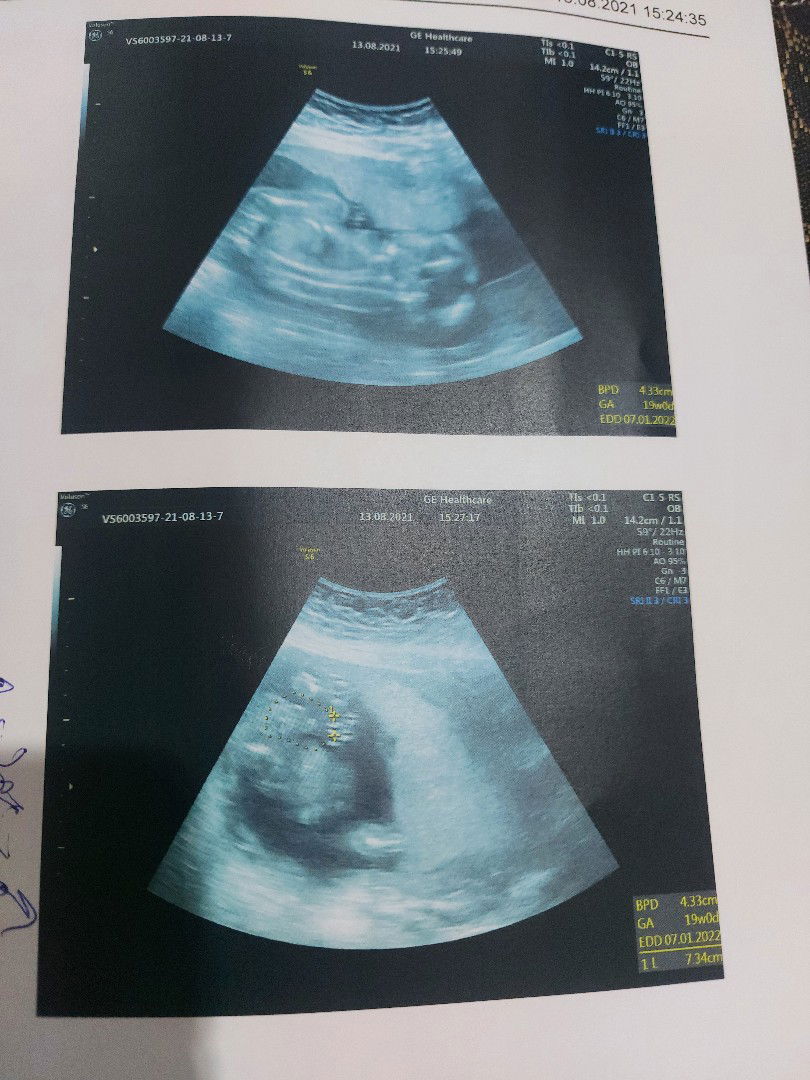 Buangoen Khuntee profile icon