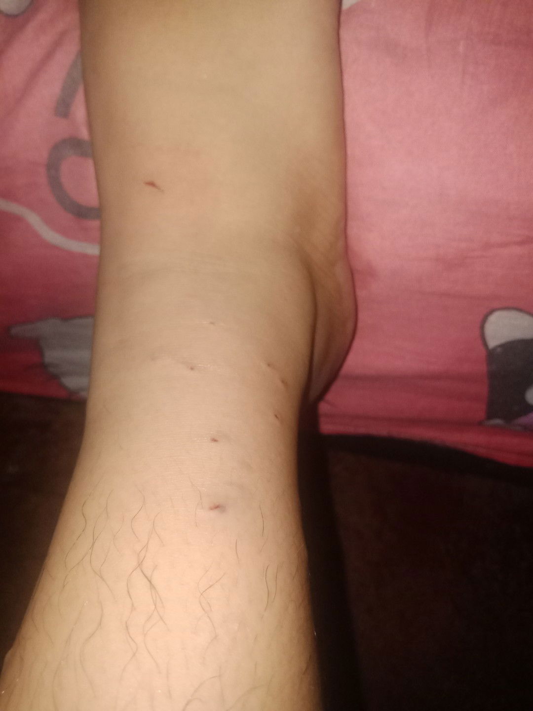 nakagat po ako ng pusa;(