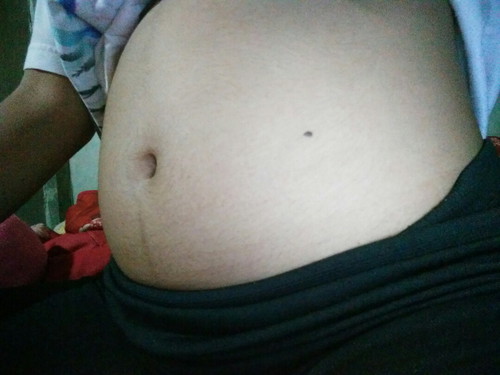 13w4d