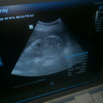 anak mamah 26Week