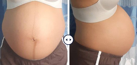 ไหนว่าท้องแรกท้องไม่ใหญ่ 5555