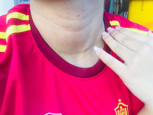 แบบนี้คืออะไรค่ะแม่ๆ มีใครเป็นไหมค่ะ