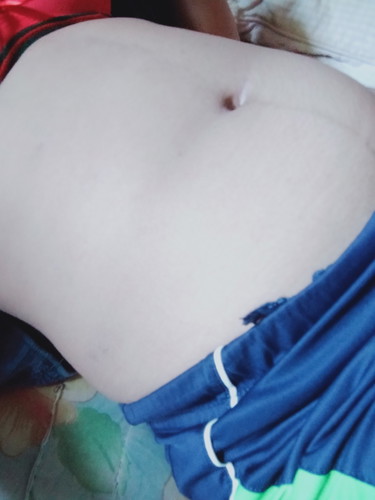 ขอดูท้องแม่ๆ หน่อยคะ