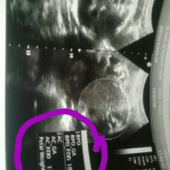 gk tau cara bacanya ?