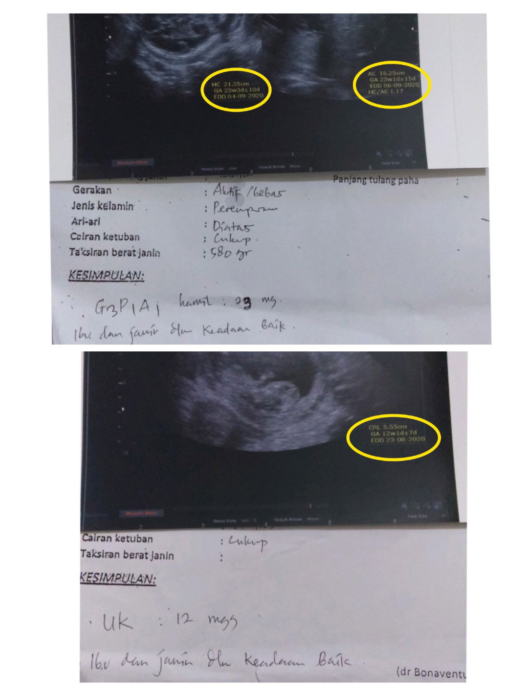 bunda2 ada gk sh yg kaya saya,,