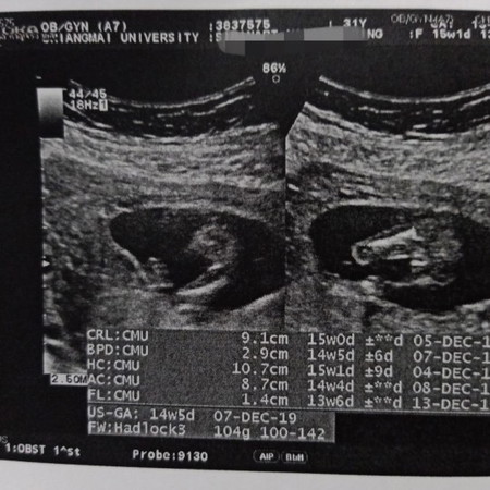 ? แบบนี้ ช หรือ ญ คะ ?