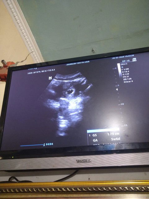 pertama kalinya positip