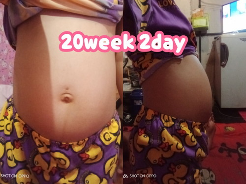 ท้องเล็กรึใหญ่20w2d💗💞