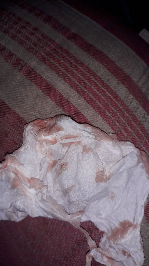 udah 3hari ini saya ngplek bun tp prut tdak merasakan nyeri apa dsni ada yg pengalaman spr