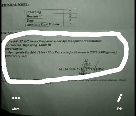 Any suggestions po mga mamsh!